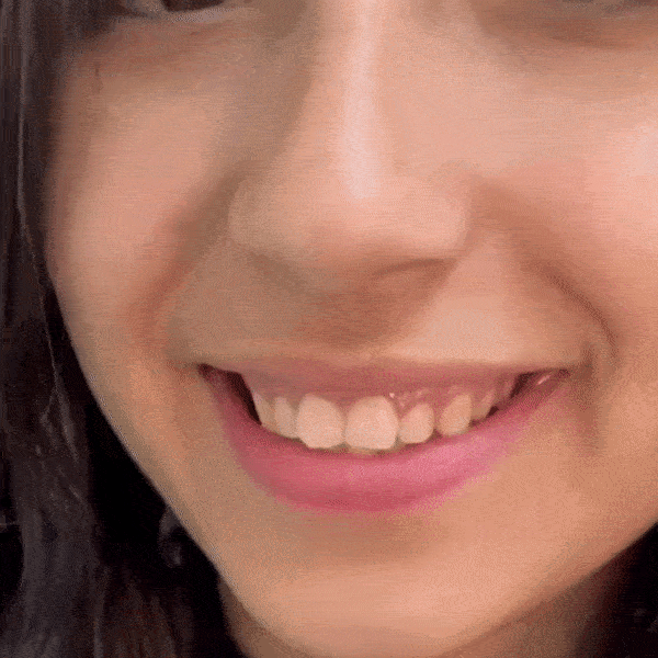 SMILEFIT PRO – ÁLLÍTHATÓ FOGPÓTLÁS KÉSZLET A TÖKÉLETES MOSOLYÉRT