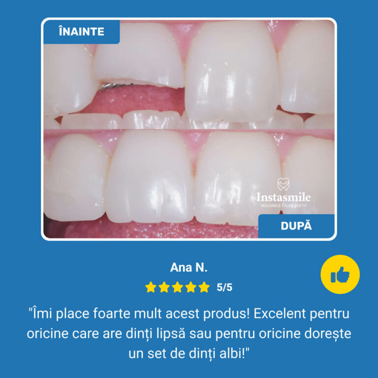 DENTIVA™ - Ideiglenes fogjavító készlet letört, hiányzó vagy hézagos fogakra
